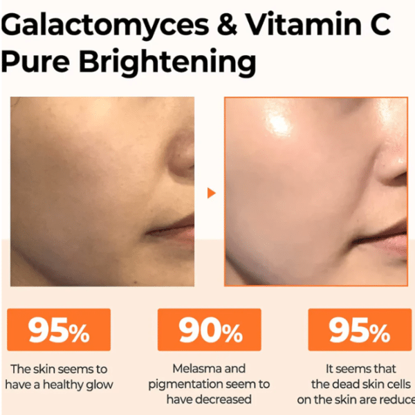 Some By Mi Galactomyces Pure Vitamin C Glow Serum 30ml - Αντιγηραντικό Serum Προσώπου με Βιταμίνη C